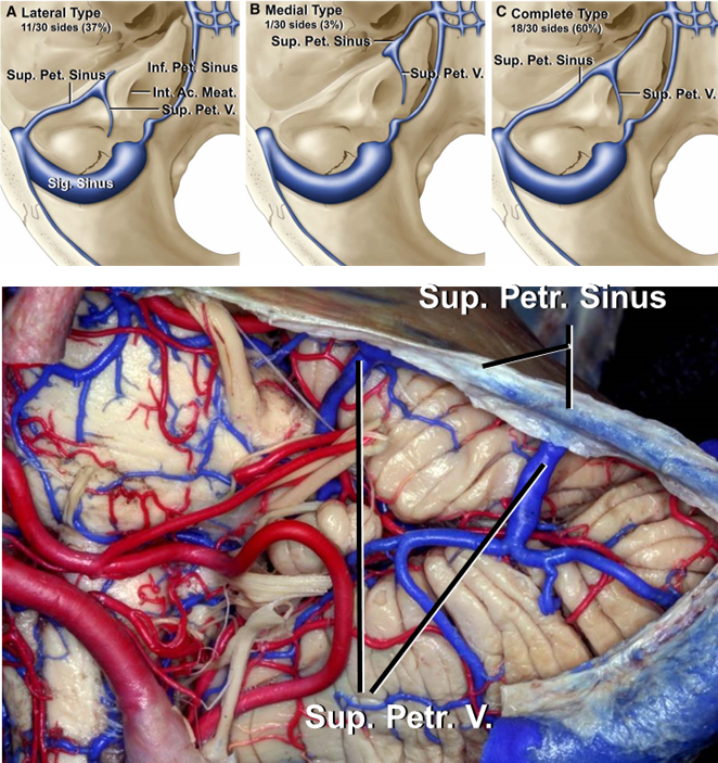 Retrosigmoid Approach