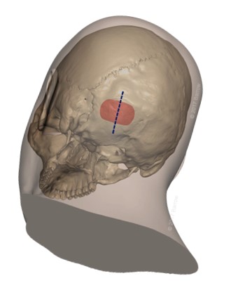 ta-heruanatomia様 楽天市場】ドーナツ クッション 椅子 低反発 痔 穴あき メモリー