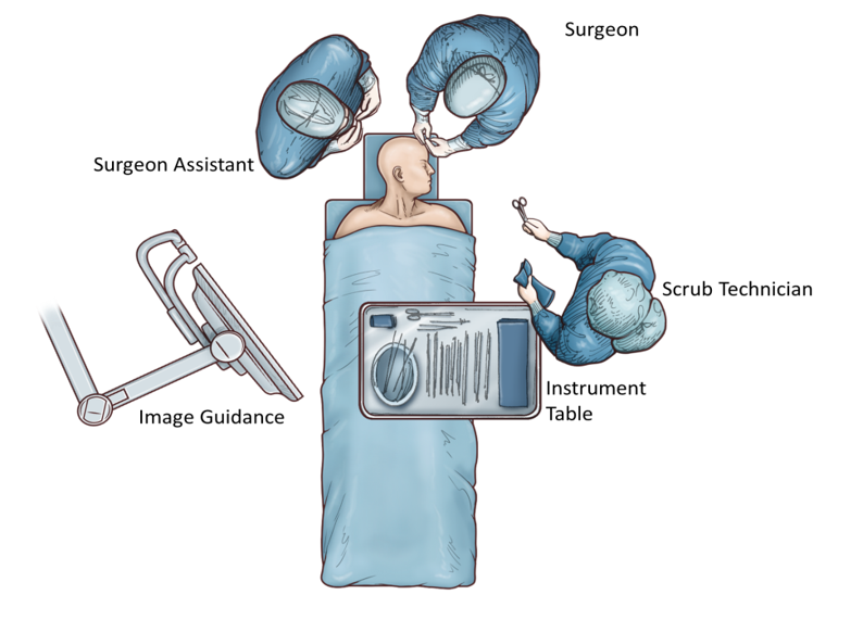 Right Sided STA-MCA Bypass for Moyamoya - cns.org