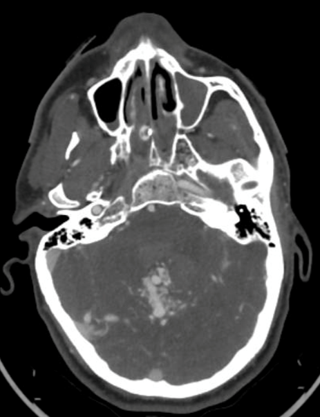 ENCYCLOPAEDIA of OCCLUSION【裁断済】 184895