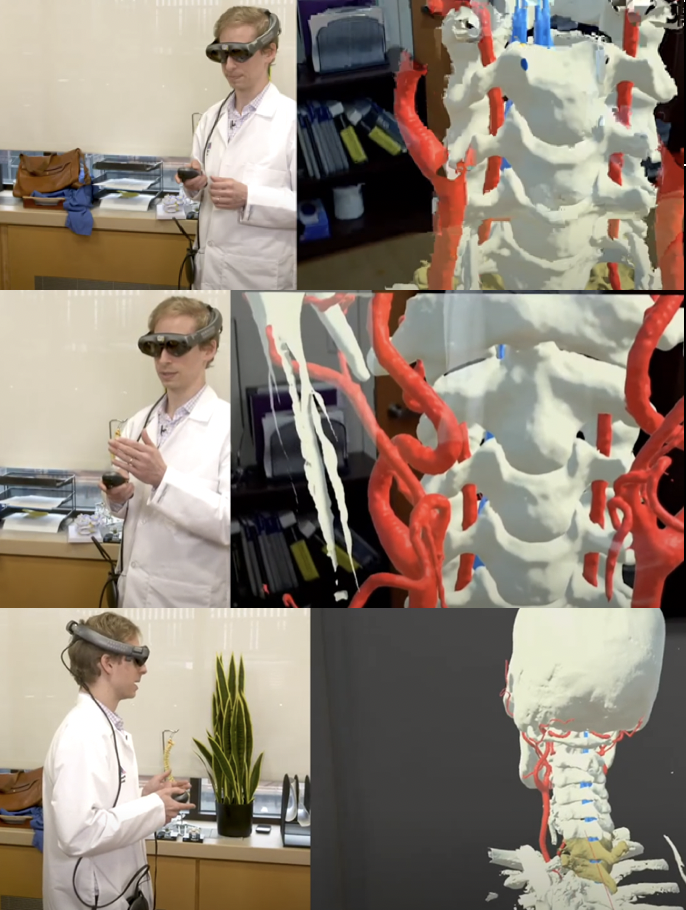 Applications Of Intra-Operative Augmented Reality During Spinal Surgery ...