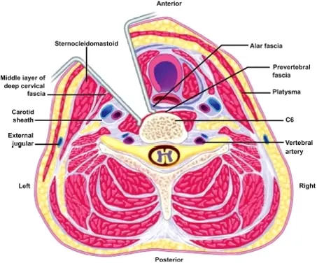 Cervical Epidural Abscess - Cns.org